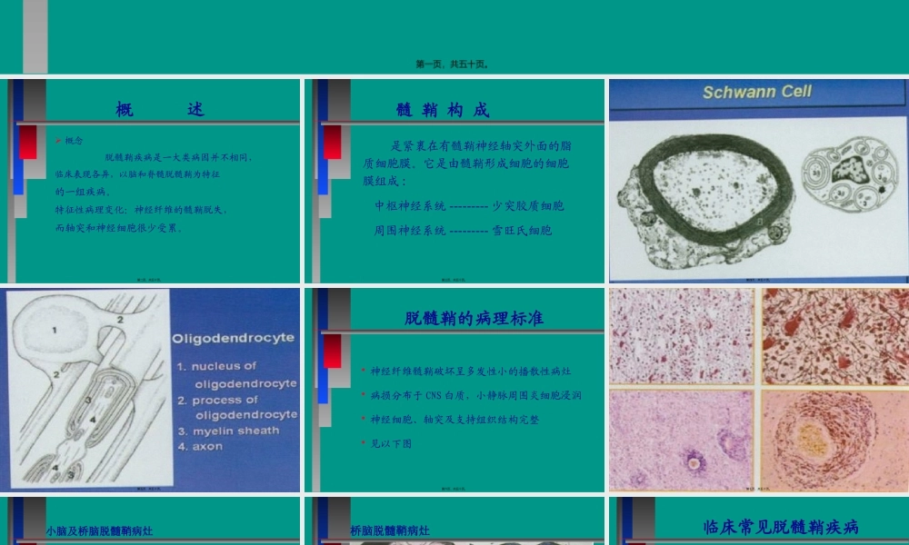 中枢神经系统脱髓壳病(详细).pptx
