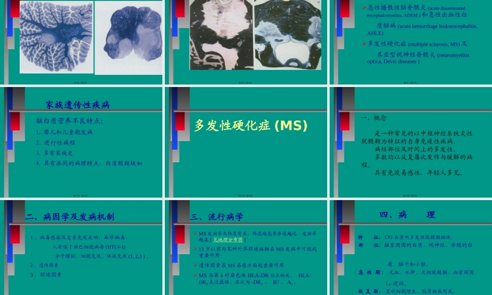 中枢神经系统脱髓壳病(详细).pptx