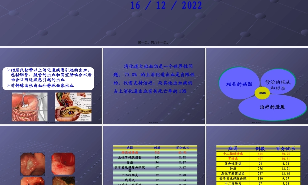 上消化道出血的诊治基础和进展.pptx
