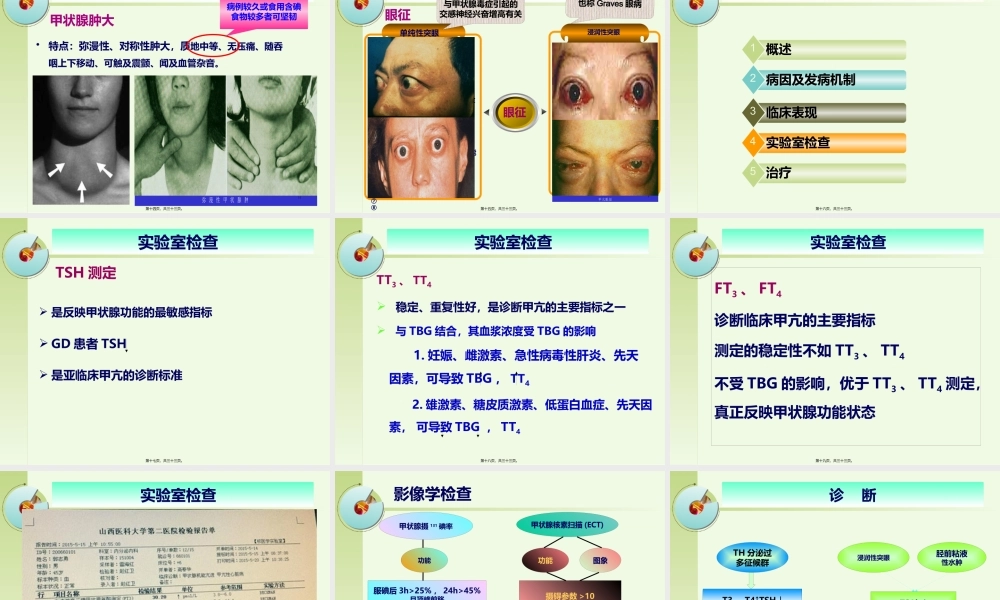 一例甲亢患者的病例讨论.pptx