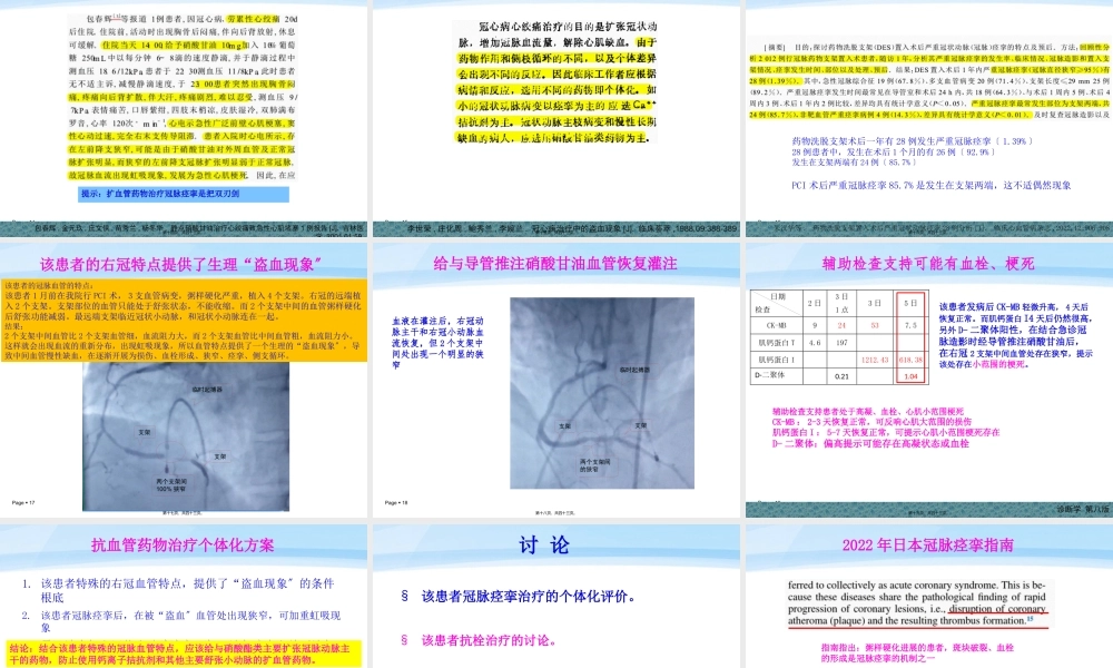 一例冠脉痉挛引起急性心肌梗死的病例讨论.pptx