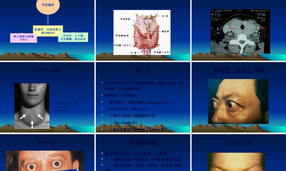 【甲亢】详解.pptx