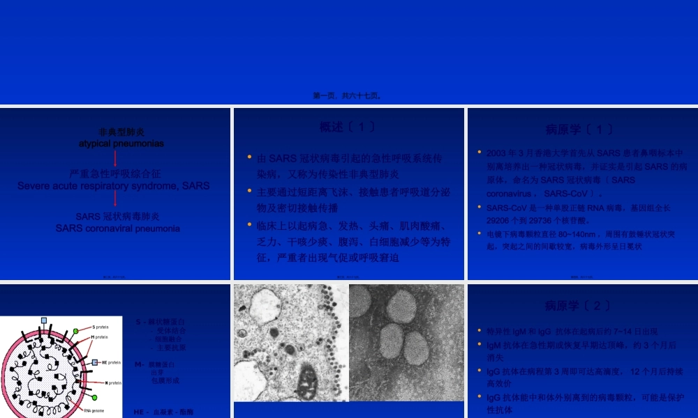 严重急性呼吸综合征.pptx