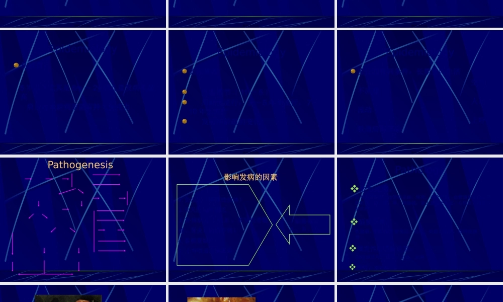 9临-流行性脑脊髓膜炎.pptx