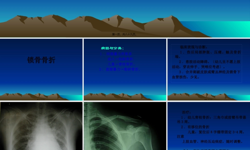 上肢骨折与关节损伤.pptx