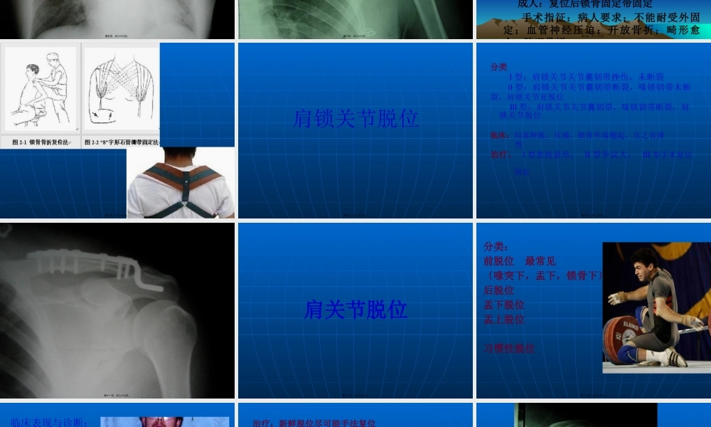 上肢骨折与关节损伤.pptx