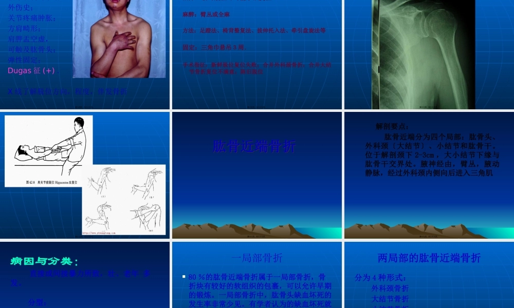 上肢骨折与关节损伤.pptx