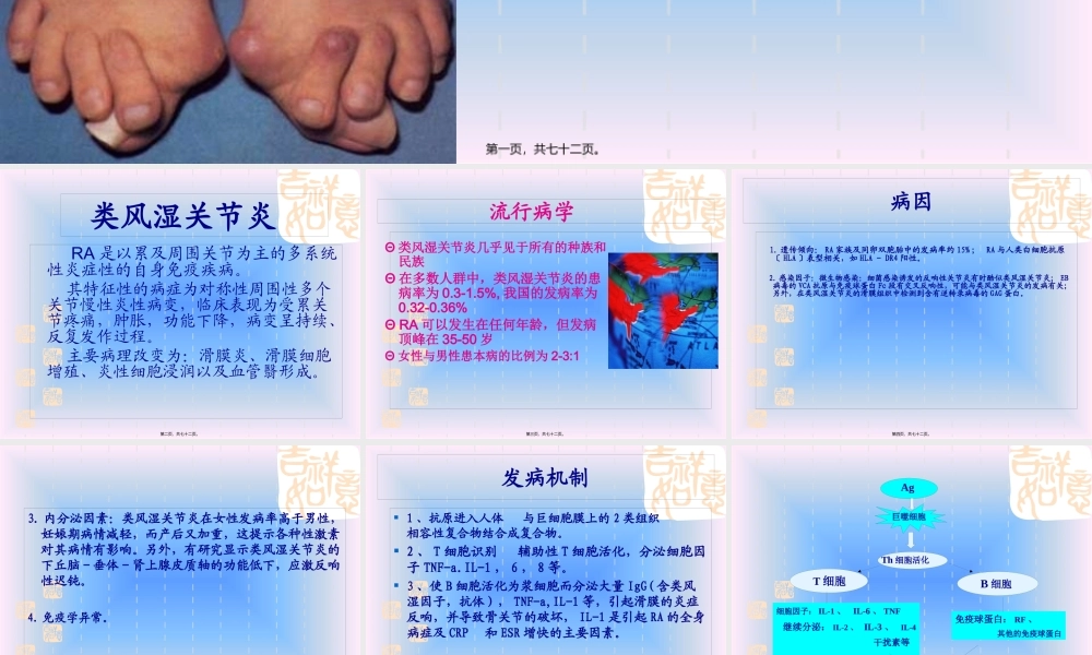 中西结合7年制教材(大量图片)类风湿性关节炎.pptx