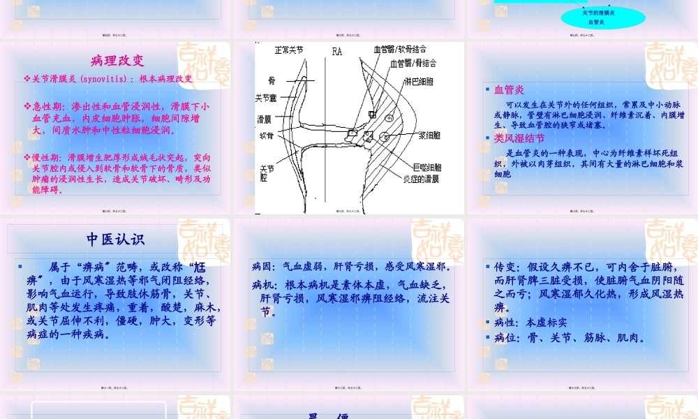 中西结合7年制教材(大量图片)类风湿性关节炎.pptx