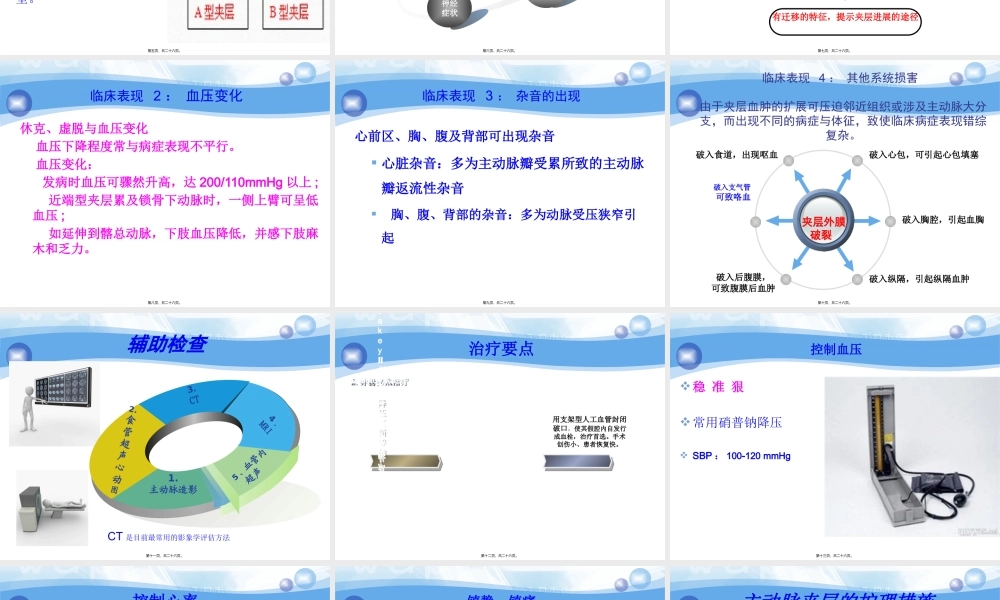 主动脉夹层的急救处理.pptx