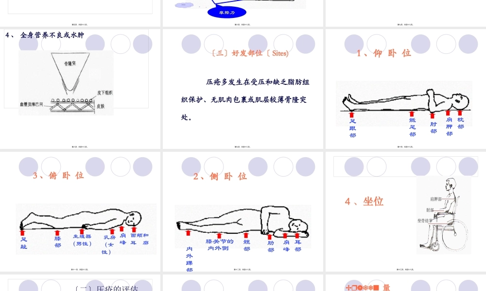 压疮教学查房.pptx