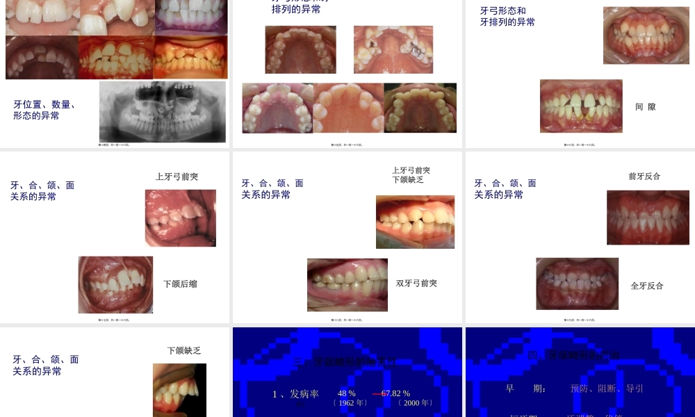 口腔正畸学-赵志河-概论.pptx