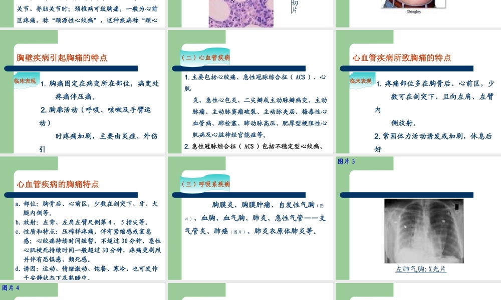 胸痛涂超梅.ppt