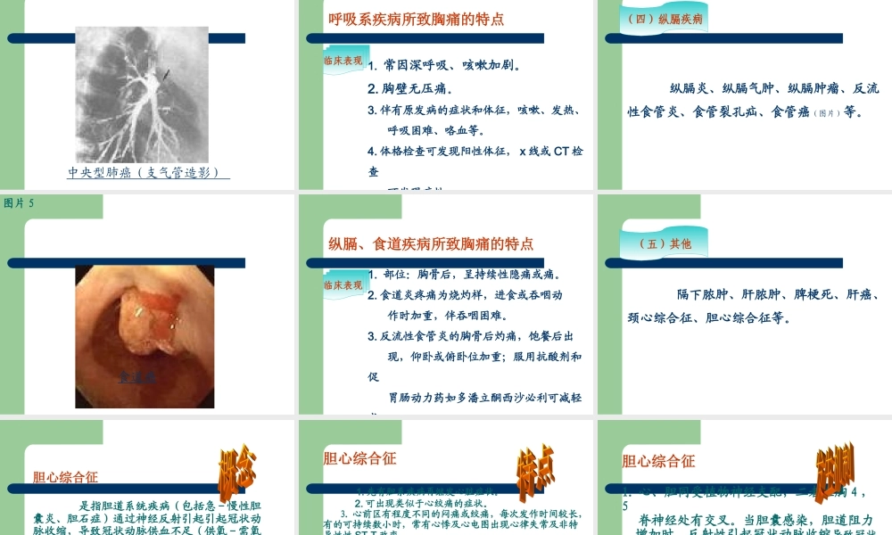 胸痛涂超梅.ppt