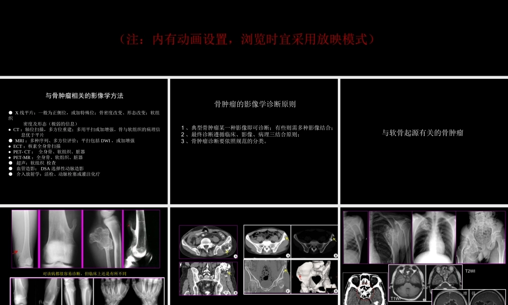 骨肿瘤影像学诊断(1).ppt