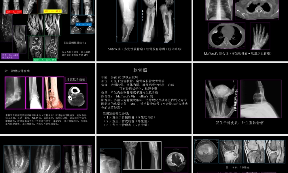 骨肿瘤影像学诊断(1).ppt