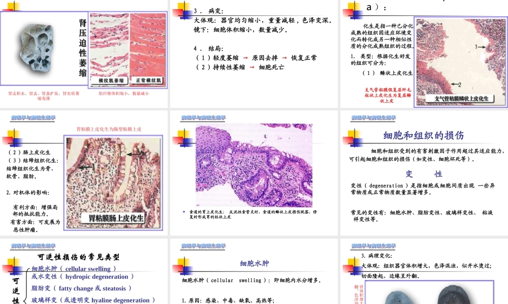 最新第一章-细胞和组织的适应、损伤与修复.ppt