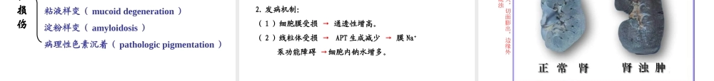 最新第一章-细胞和组织的适应、损伤与修复.ppt