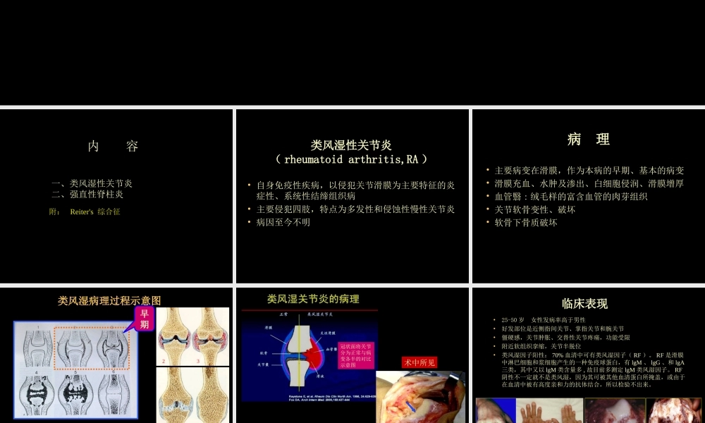类风湿性、强直性脊柱炎的影像学诊断(1).ppt