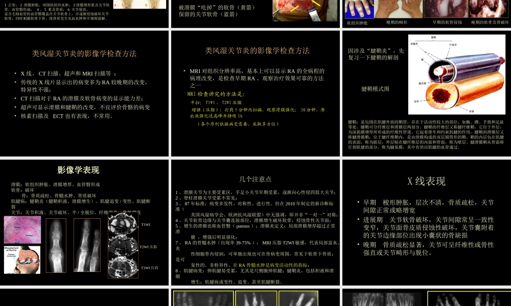 类风湿性、强直性脊柱炎的影像学诊断(1).ppt