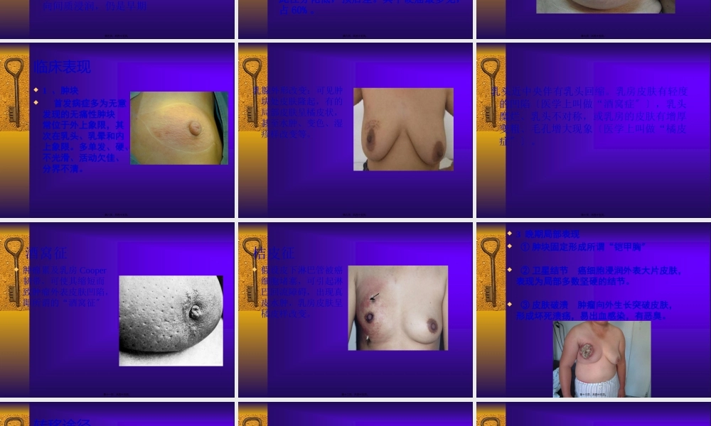 乳腺癌-2概述.pptx