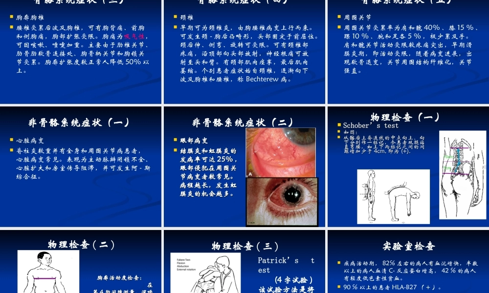 强直性脊柱炎早期诊治新进展.ppt