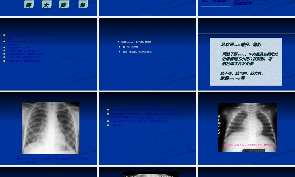 2022年医学专题—临-床-医-学-概-论.肺炎.ppt
