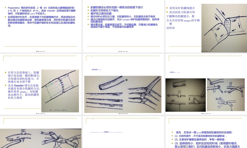 2022年医学专题—肌腱损伤及修复.ppt