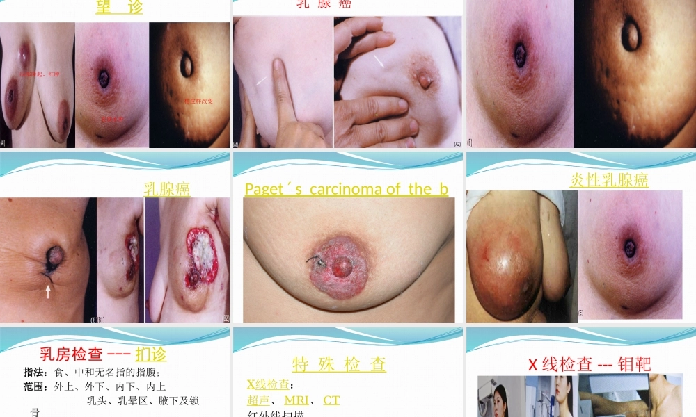 91乳腺外科-乳腺(1).pptx