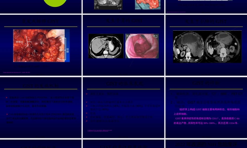 GIST诊治现状.pptx