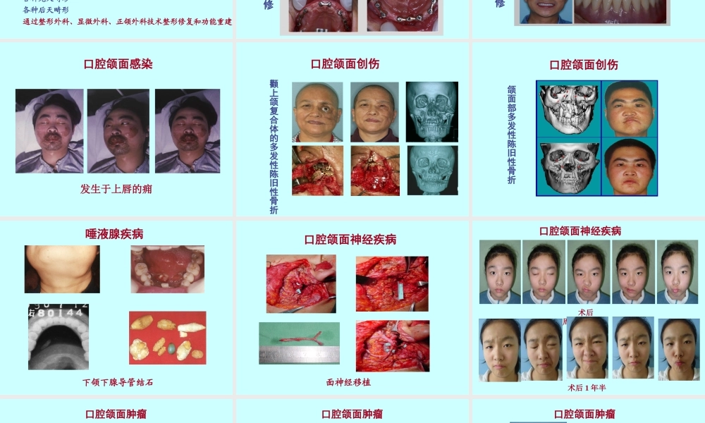 口腔颌面外科学绪论（2016.2）(1).ppt