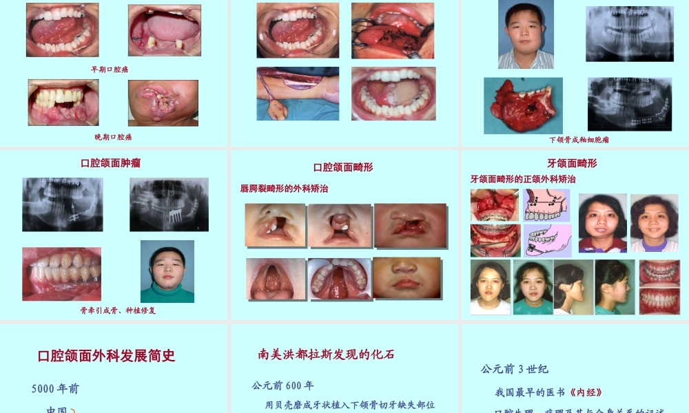 口腔颌面外科学绪论（2016.2）(1).ppt
