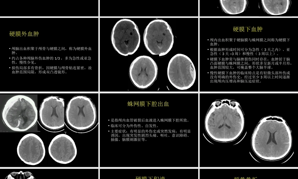 急症影像学诊断(1).pptx