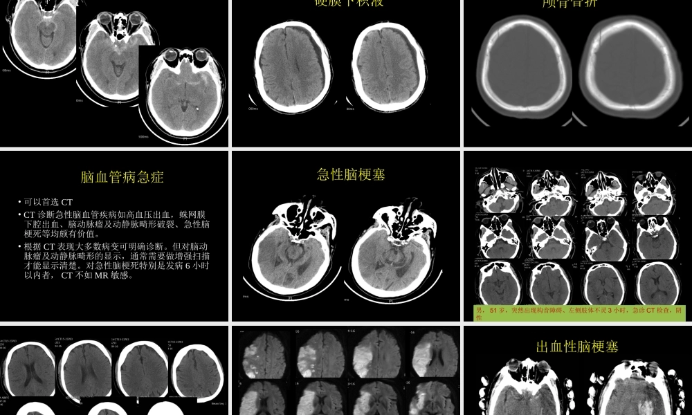 急症影像学诊断(1).pptx