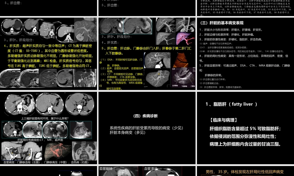 肝胆胰影像学诊断(1).ppt