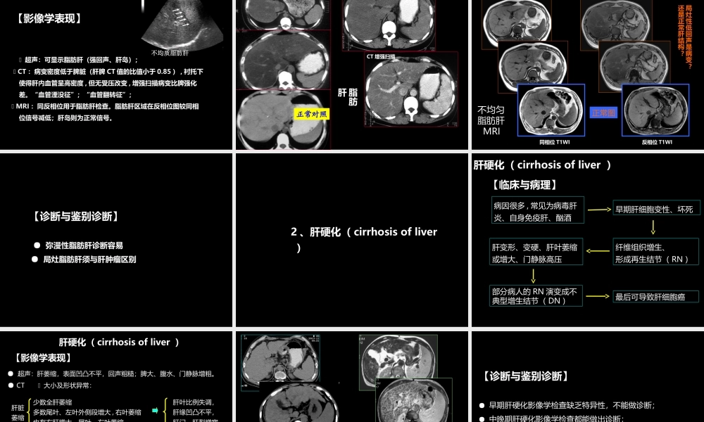 肝胆胰影像学诊断(1).ppt