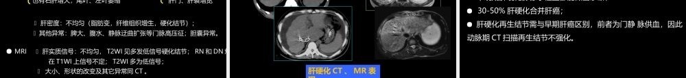 肝胆胰影像学诊断(1).ppt