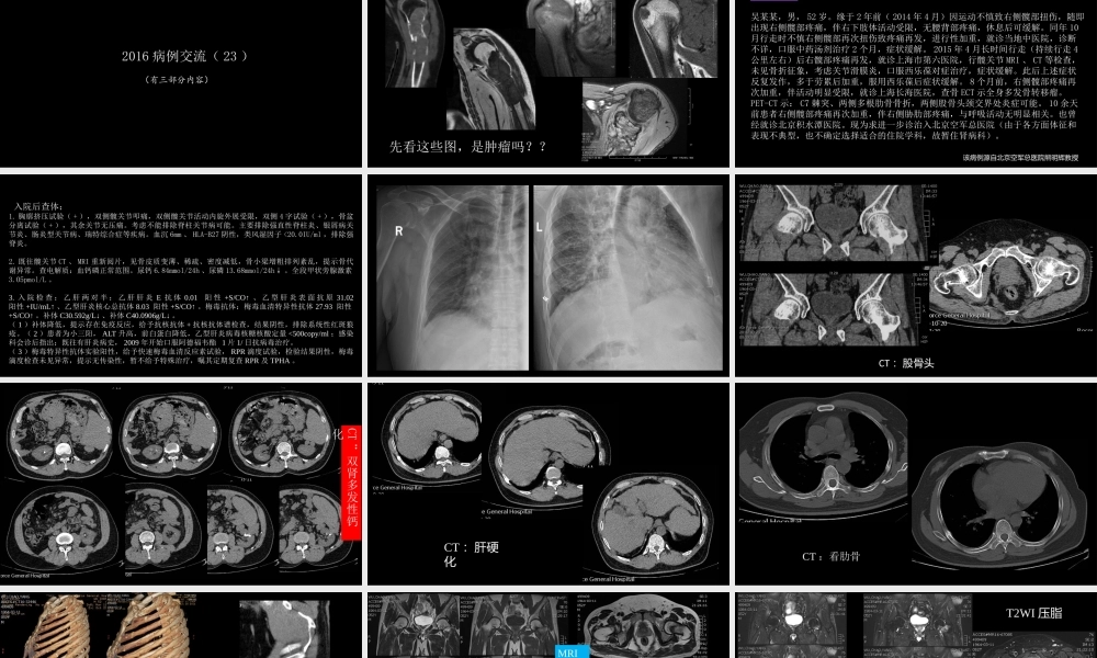 影像诊断学习与扩展：代谢性骨病(病例23)(1).pptx