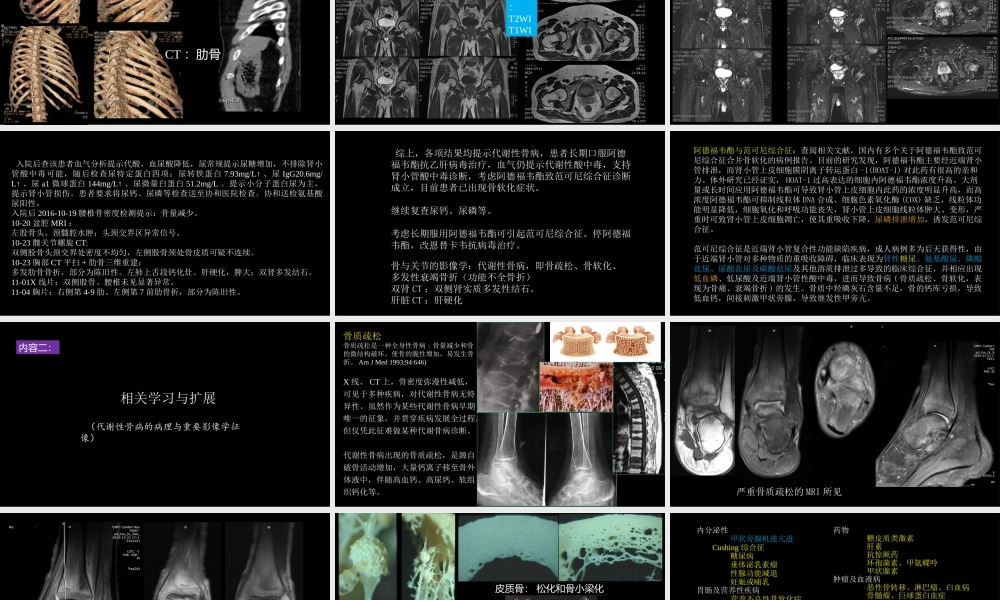 影像诊断学习与扩展：代谢性骨病(病例23)(1).pptx