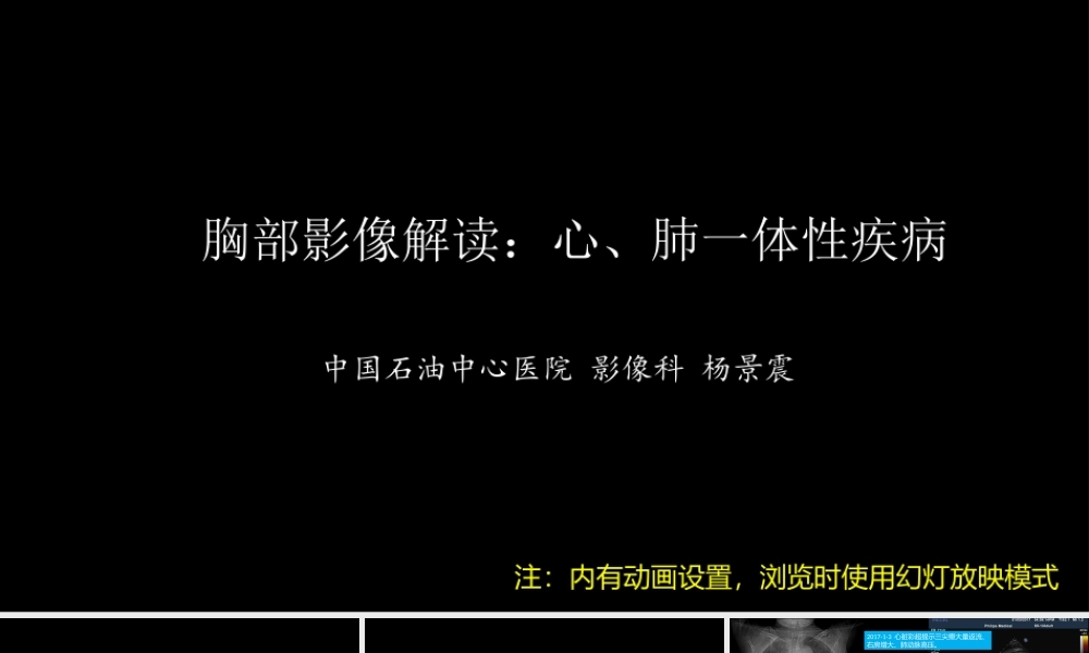 胸部影像解读：心肺一体性疾病(1).pptx