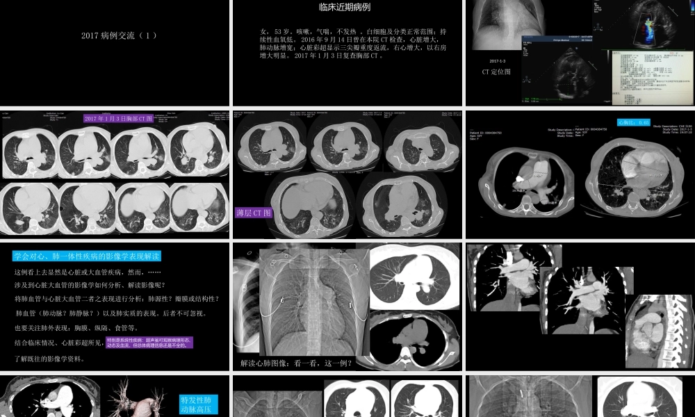 胸部影像解读：心肺一体性疾病(1).pptx