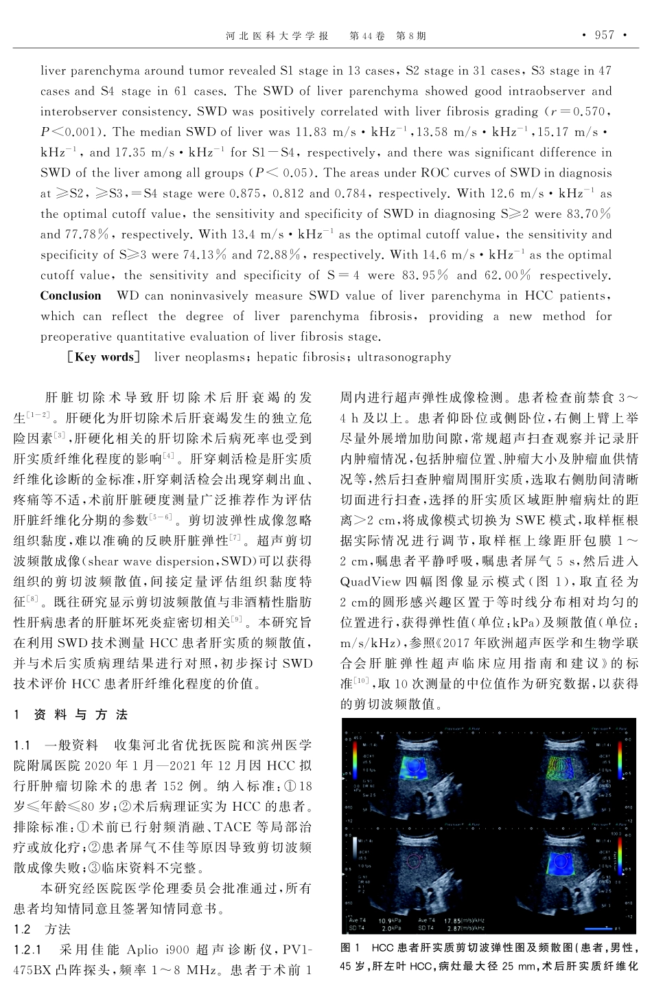超声剪切波频散成像术前评估肝细胞肝癌患者肝纤维化的初步临床研究.pdf_第2页