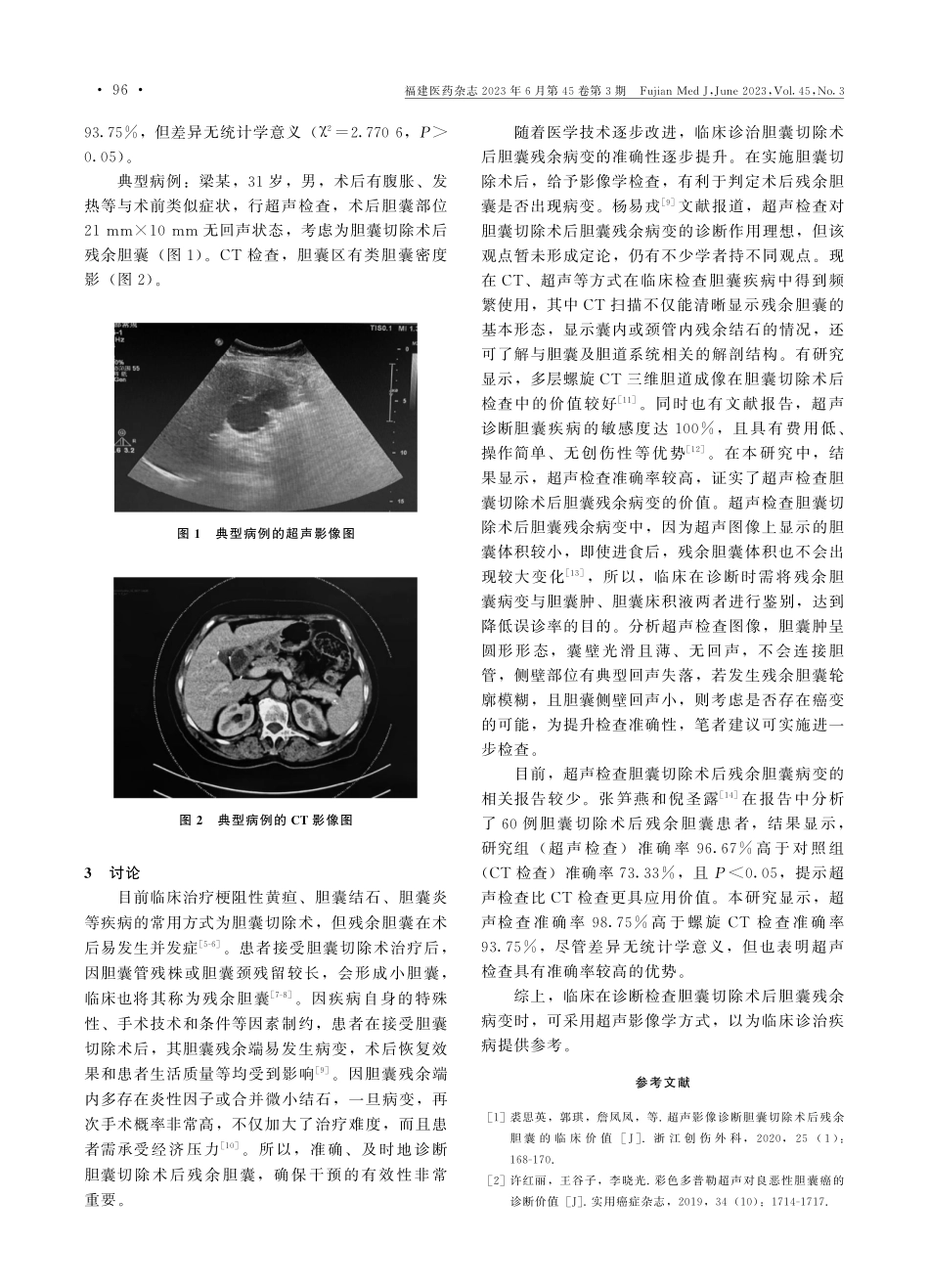 超声影像诊断胆囊切除术后胆囊残余病变的价值.pdf_第2页