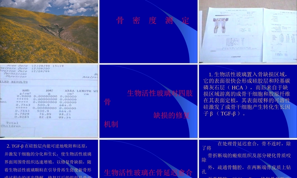 固骼生应用2.ppt