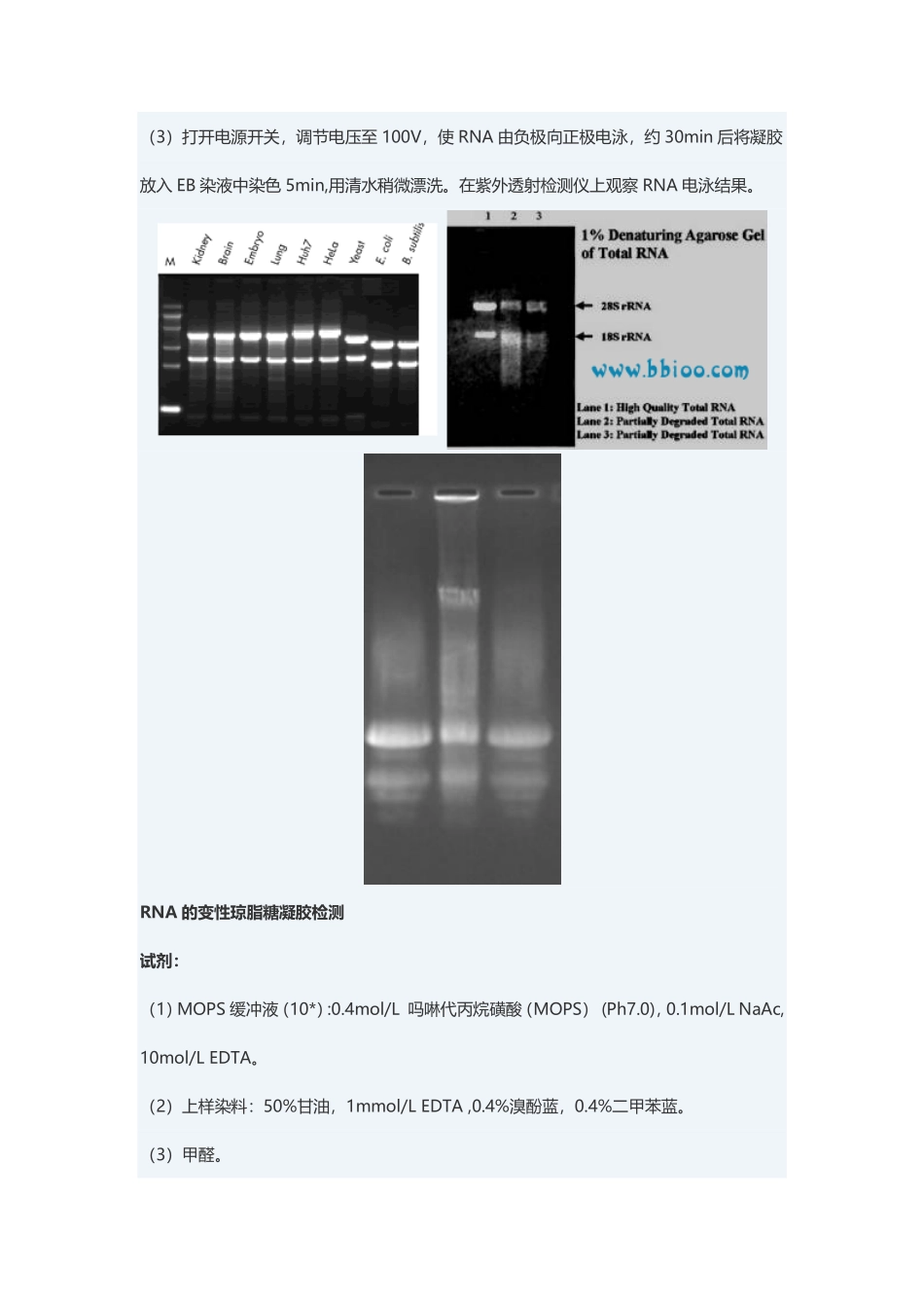 RNA琼脂糖凝胶电泳(2).pdf_第2页