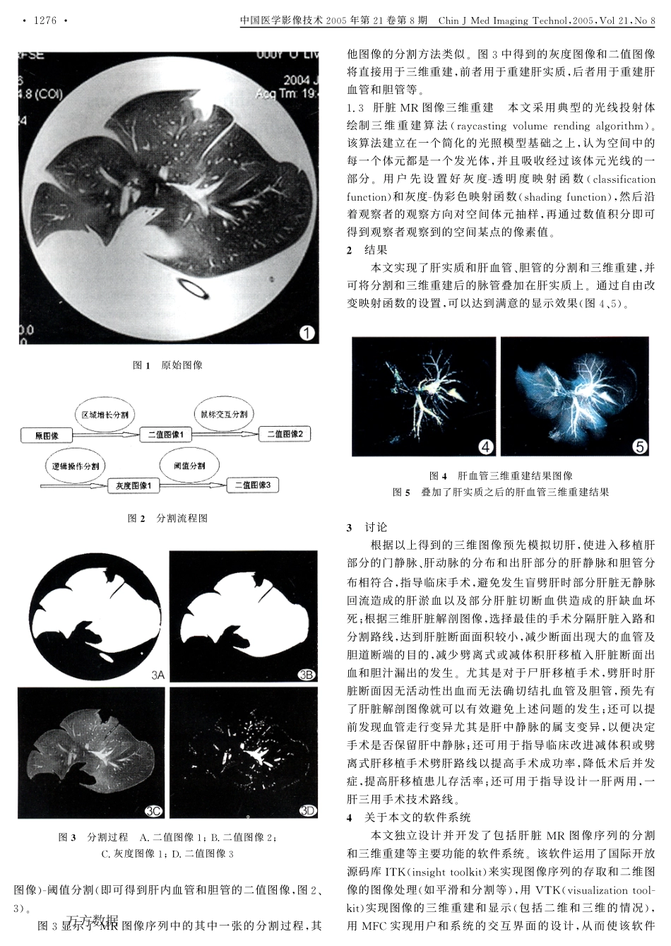 基于MRI的动物肝脏脉管分割与三维重建.pdf_第2页