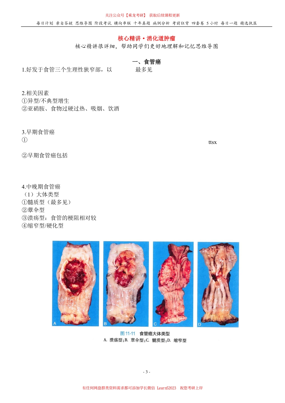 填空式讲义：病理 消化道肿瘤 核心-导图-真题-串联 天天师兄24考研 冲.pdf_第3页
