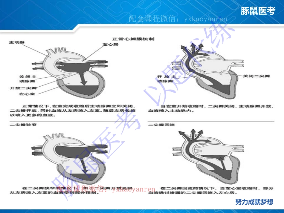 WM_4.心内科-真题课-心脏瓣膜病 .pdf_第2页