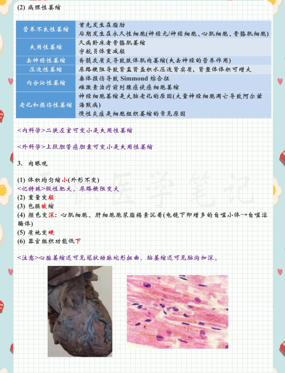 医学笔记-病理学 .pdf_第2页
