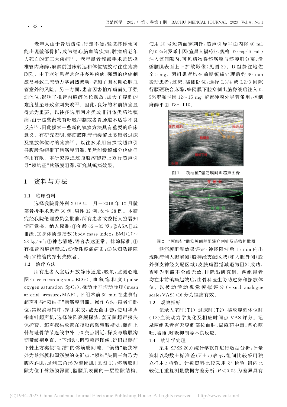 “领结征”髂筋膜阻滞对老年髋部骨折患者术前镇痛的效果_刘艳军.pdf_第2页